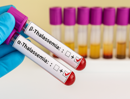 articulo_talasemias